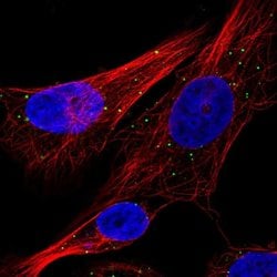 Invitrogen Cathepsin C Polyclonal Antibody 100 &mu;L; Unconjugated:Antibodies,