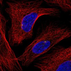 GRAP Polyclonal Antibody:Antibodies, Polyclonal