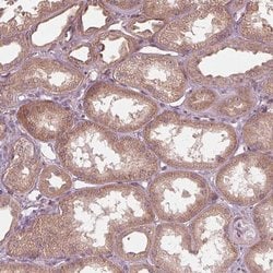 Invitrogen CMIP Polyclonal Antibody 100 &mu;L; Unconjugated:Antibodies,