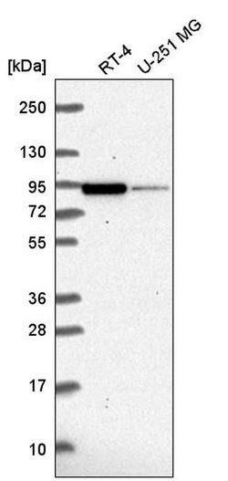 Invitrogen CMIP Polyclonal Antibody 100 &mu;L; Unconjugated:Antibodies,