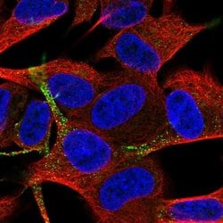 Invitrogen TSPAN11 Polyclonal Antibody 100 &mu;L | Buy Online | Invitrogen&trade; | Fisher Scientific