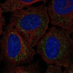 Invitrogen RP11-80H18.3 Polyclonal Antibody 100 &mu;L; Unconjugated:Antibodies,