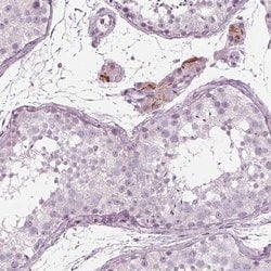 Invitrogen KRT28 Polyclonal Antibody 100 &mu;L; Unconjugated:Antibodies,