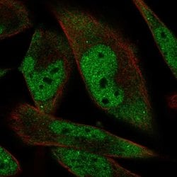 Invitrogen RBM24 Polyclonal Antibody 100 &mu;L; Unconjugated:Antibodies,