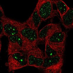 Invitrogen BAZ1B Polyclonal Antibody 100 &mu;L; Unconjugated:Antibodies,