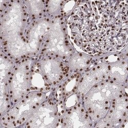 Invitrogen THAP3 Polyclonal Antibody 100 &mu;L; Unconjugated:Antibodies,