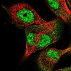 Invitrogen USP24 Polyclonal Antibody 100 &mu;L; Unconjugated:Antibodies,