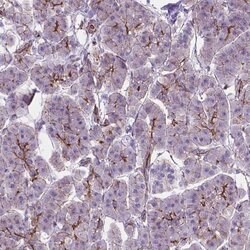 Invitrogen ARMS2 Polyclonal Antibody 100 &mu;L; Unconjugated:Antibodies,