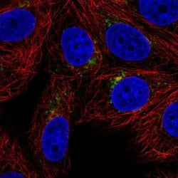 Invitrogen SPPL2A Polyclonal Antibody 100 &mu;L; Unconjugated:Antibodies,