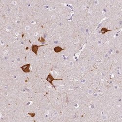Invitrogen FAM163B Polyclonal Antibody 100 &mu;L; Unconjugated:Antibodies,