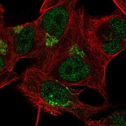 Invitrogen TBC1D14 Polyclonal Antibody 100 &mu;L | Buy Online | Invitrogen&trade; | Fisher Scientific