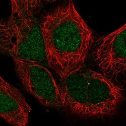 Invitrogen MAN2C1 Polyclonal Antibody 100 &mu;L; Unconjugated:Antibodies,