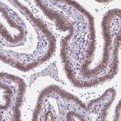 Invitrogen MAN2C1 Polyclonal Antibody 100 &mu;L; Unconjugated:Antibodies,