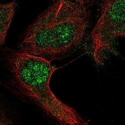RGS12 Polyclonal Antibody:Antibodies, Polyclonal