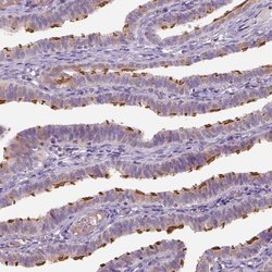 Invitrogen IFT52 Polyclonal Antibody 100 &mu;L; Unconjugated:Antibodies,