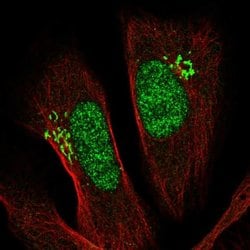 Invitrogen PSMD11 Polyclonal Antibody 100 &mu;L; Unconjugated:Antibodies,