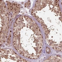 Invitrogen PSMD11 Polyclonal Antibody 100 &mu;L; Unconjugated:Antibodies,