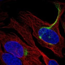 Invitrogen C19orf25 Polyclonal Antibody 100 &mu;L; Unconjugated:Antibodies,
