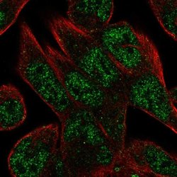 Invitrogen C16orf72 Polyclonal Antibody 100 &mu;L; Unconjugated:Antibodies,