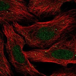Invitrogen SLC30A3 Polyclonal Antibody 100 &mu;L | Buy Online | Invitrogen&trade; | Fisher Scientific