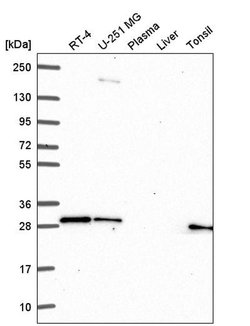 Invitrogen GBX2 Polyclonal Antibody 100 &mu;L; Unconjugated:Antibodies,