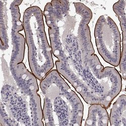 Invitrogen SLC22A18 Polyclonal Antibody 100 &mu;L; Unconjugated:Antibodies,