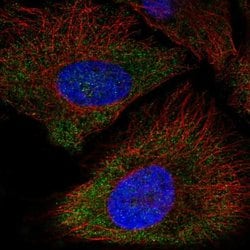 Invitrogen P2X5 Polyclonal Antibody 100 &mu;L; Unconjugated:Antibodies,