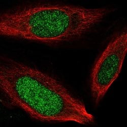 Invitrogen NCAPH2 Polyclonal Antibody 100 &mu;L; Unconjugated:Antibodies,