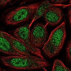 Invitrogen ZNF630 Polyclonal Antibody 100 &mu;L; Unconjugated:Antibodies,