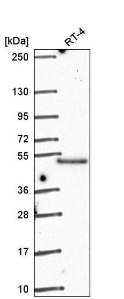 Invitrogen GRINL1A Polyclonal Antibody 100 &mu;L; Unconjugated:Antibodies,