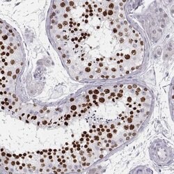 Invitrogen Histone H1T Polyclonal Antibody 100 &mu;L; Unconjugated:Antibodies,