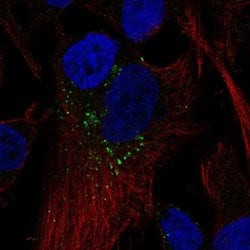 RAB5B Polyclonal Antibody:Antibodies, Polyclonal