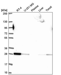 RAB5B Polyclonal Antibody:Antibodies, Polyclonal