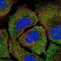 Invitrogen TPTE2 Polyclonal Antibody 100 &mu;L; Unconjugated:Antibodies,