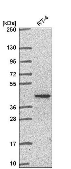 Invitrogen PCBP1 Polyclonal Antibody 100 &mu;L; Unconjugated:Anticuerpos