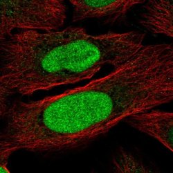 Invitrogen ZNF776 Polyclonal Antibody 100 &mu;L; Unconjugated:Antibodies,