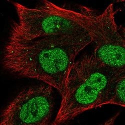 Invitrogen RRAGD Polyclonal Antibody 100 &mu;L; Unconjugated:Antibodies,