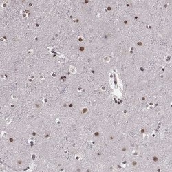 Invitrogen RRAGD Polyclonal Antibody 100 &mu;L; Unconjugated:Antibodies,
