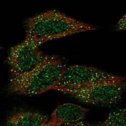 Invitrogen CECR6 Polyclonal Antibody 100 &mu;L; Unconjugated:Antibodies,