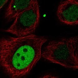 Invitrogen KIF23 Polyclonal Antibody 100 &mu;L; Unconjugated:Antibodies,