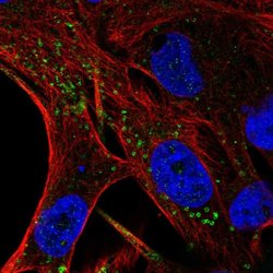 FIG4 Polyclonal Antibody, Invitrogen 100 &mu;L | Buy Online | Invitrogen | Fisher Scientific