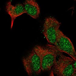 Invitrogen EXTL2 Polyclonal Antibody 100 &mu;L; Unconjugated:Antibodies,