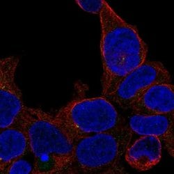 Invitrogen&trade;&nbsp;ZNF747 Polyclonal Antibody