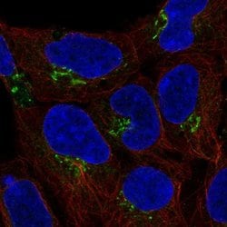 Invitrogen C4orf32 Polyclonal Antibody 100 &mu;L | Buy Online | Invitrogen&trade; | Fisher Scientific