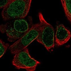 Invitrogen LRR1 Polyclonal Antibody 100 &mu;L; Unconjugated:Antibodies,
