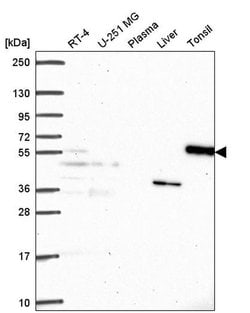 Invitrogen LRR1 Polyclonal Antibody 100 &mu;L; Unconjugated:Antibodies,