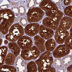 Invitrogen TM4SF18 Polyclonal Antibody 100 &mu;L; Unconjugated:Antibodies,