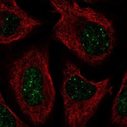 Invitrogen CNOT7 Polyclonal Antibody 100 &mu;L; Unconjugated:Antibodies,