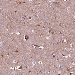 Invitrogen GDF11 Polyclonal Antibody 100 &mu;L; Unconjugated:Antibodies,
