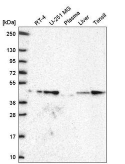 Invitrogen GDF11 Polyclonal Antibody 100 &mu;L; Unconjugated:Antibodies,